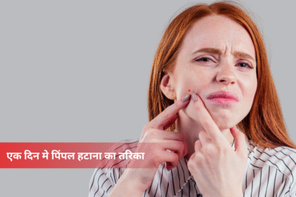 Remove Pimple in 1 day
