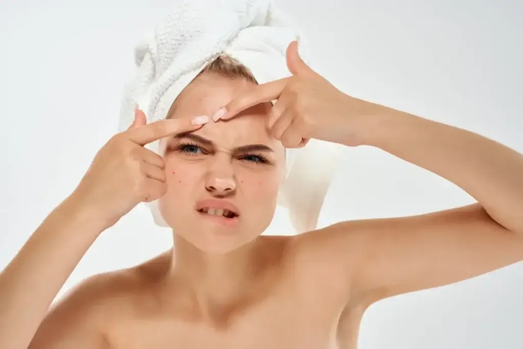 1 दिन में पिंपल हटाने का घरेलू उपाय और आसान नुस्खे 6 Tips to Prevent Pimples