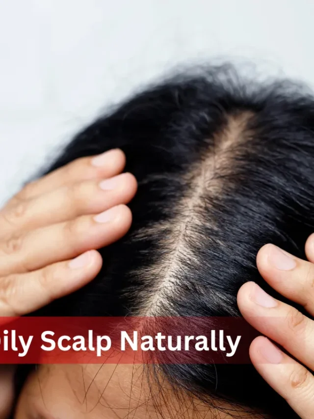 cropped-How-to-Get-Rid-of-an-Oily-Scalp-Naturally-at-Home.webp
