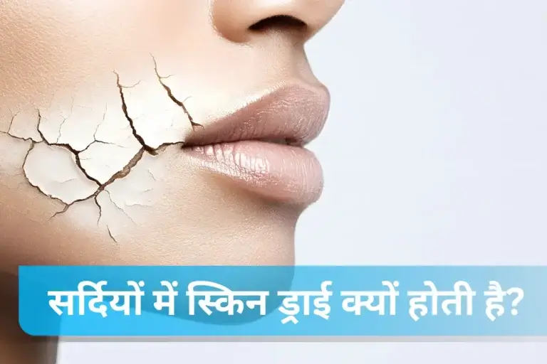 सर्दियों में स्किन ड्राई क्यों होती है